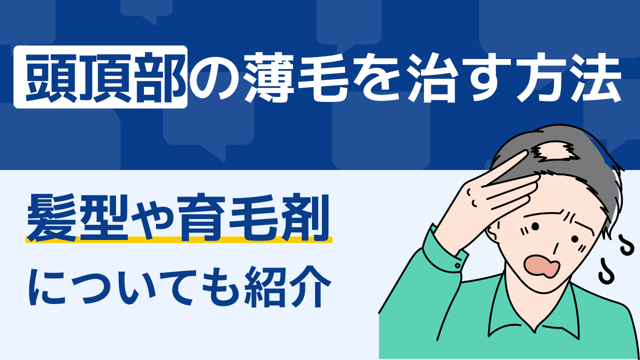 頭頂部の薄毛を治す方法｜髪型や育毛剤についても紹介