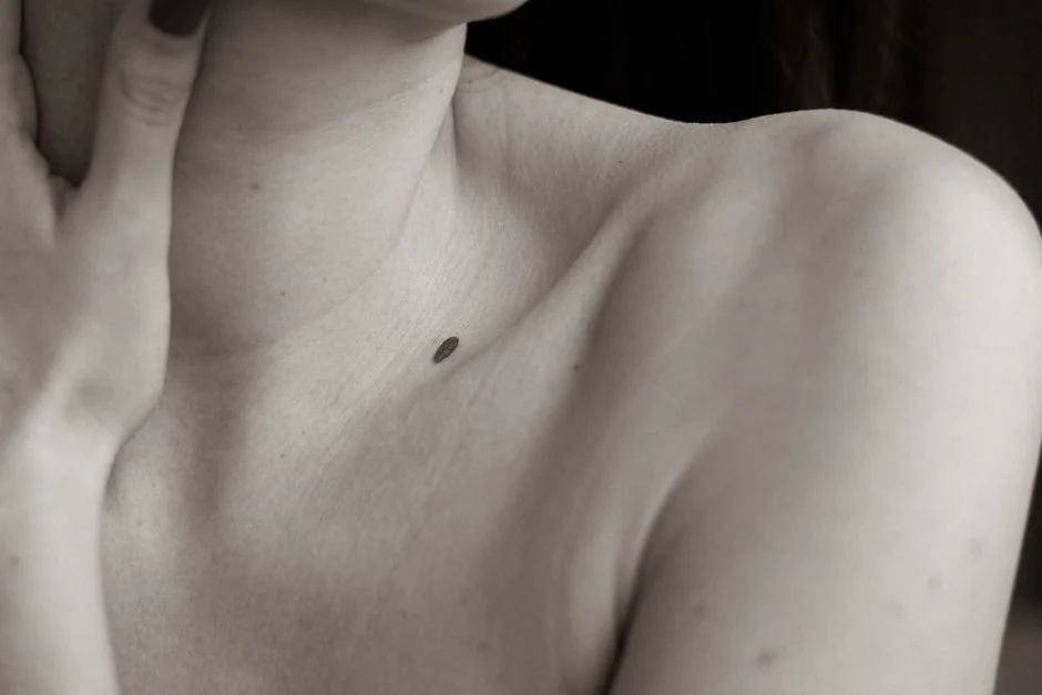Mole removal Tokyo: cost and procedure at a Japane — What Is Mole Removal