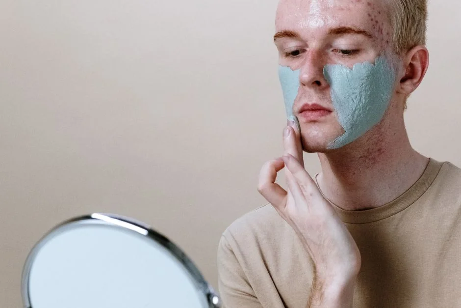 Acne treatment at a Tokyo dermatologist: what to e — Cost of Acne Treatment in Tokyo