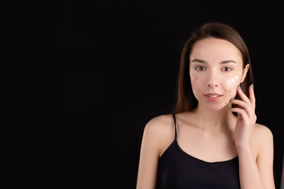 Acne treatment at a Tokyo dermatologist: what to e — What to Expect: Before, During, and After Your Appointment