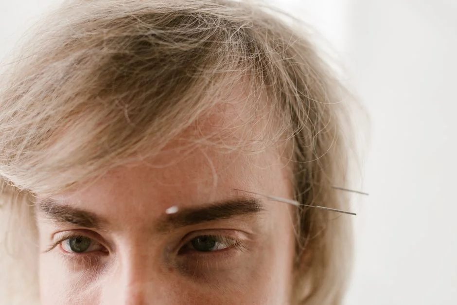 Hairline artmake Tokyo: forehead reduction and den — Healing Timeline and Aftercare