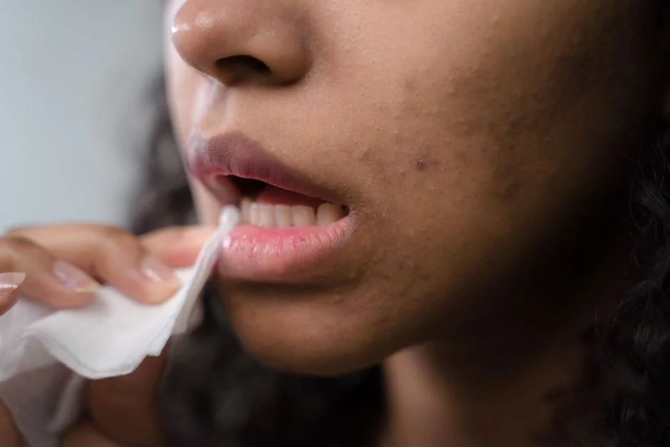 Acne treatment at a Tokyo dermatologist: what to e — What Happens at Your First Appointment in Tokyo