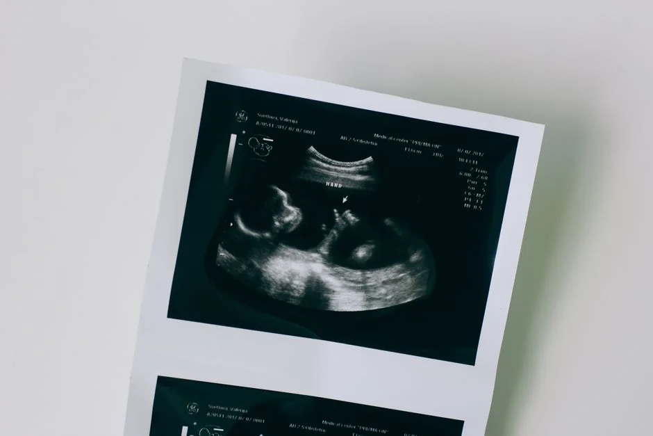 prenatal — What to test and when: a preconception and pregnancy timelin prenatal — What to test and when: a preconception and pregnancy timelin