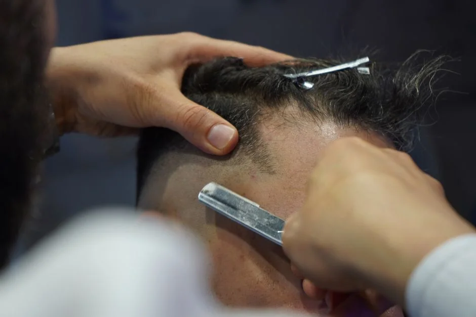 Hairline artmake Tokyo: forehead reduction and den — Who Is a Good Candidate, and What Are the Risks
