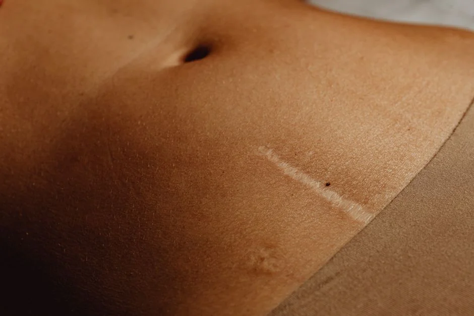 Scar revision surgery Tokyo: options and cost — Scar Revision Cost in Tokyo