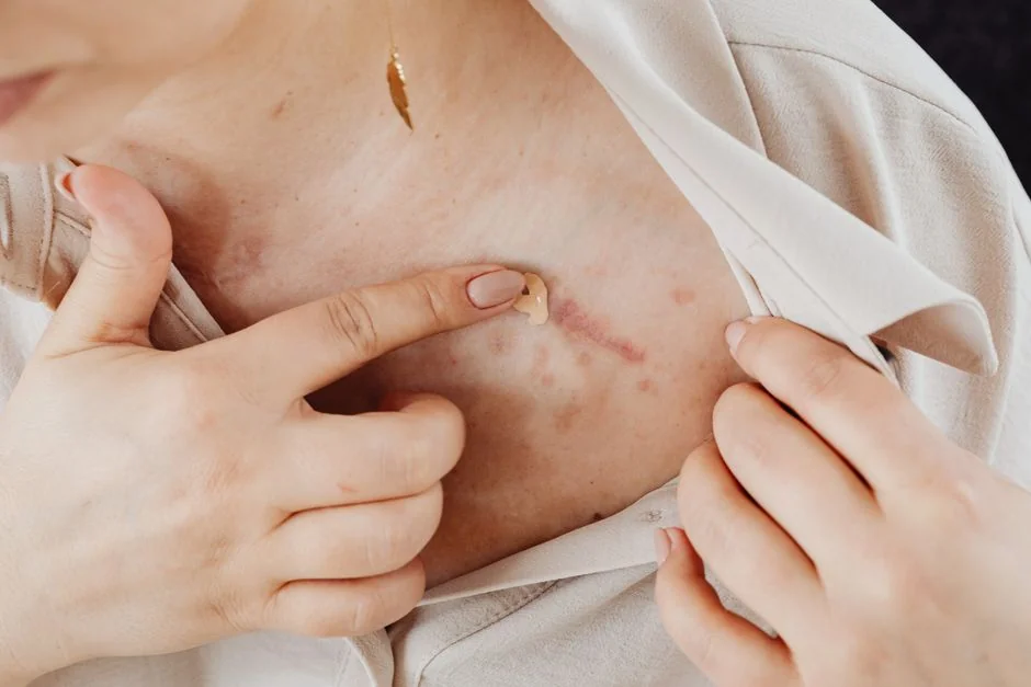 Scar revision surgery Tokyo: options and cost — Scar Revision Surgery in Tokyo: Options, Realistic Expectati