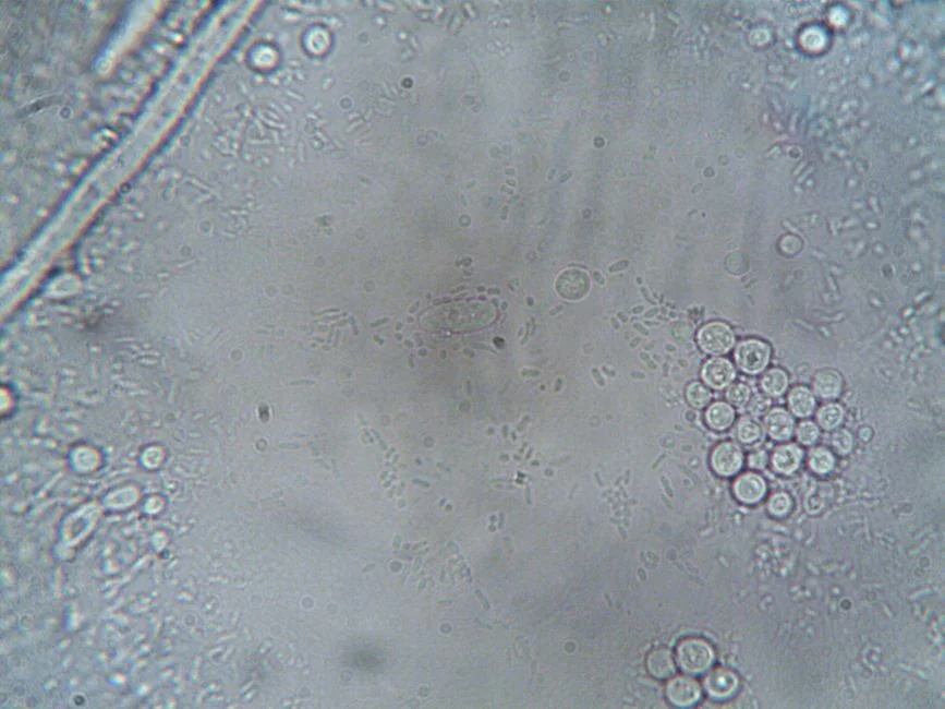 Regenerative medicine Tokyo: stem cell vs exosome — How Each Approach Works: The Science in Plain Language Regenerative medicine Tokyo: stem cell vs exosome — How Each Approach Works: The Science in Plain Language