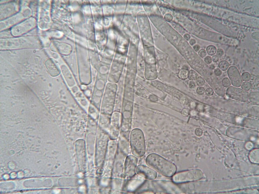 Gut microbiome testing Tokyo: what it reveals abou — How Gut Microbiome Testing Works Gut microbiome testing Tokyo: what it reveals abou — How Gut Microbiome Testing Works