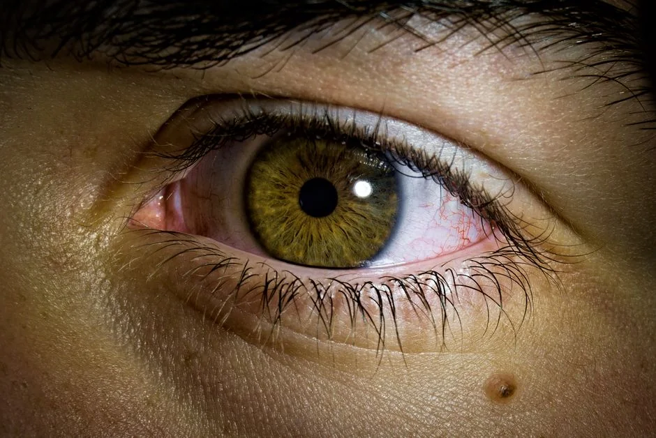 Epicanthoplasty in Tokyo: opening the inner corner — Who Is a Good Candidate