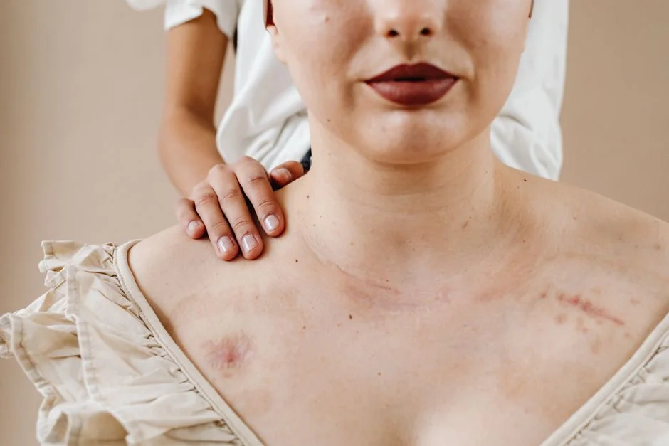 Scar revision surgery Tokyo: options and cost — Where to Get Scar Revision in Tokyo