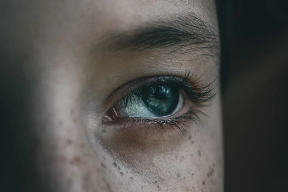Melasma treatment Tokyo: causes and solutions — Cost of Melasma Treatment in Tokyo