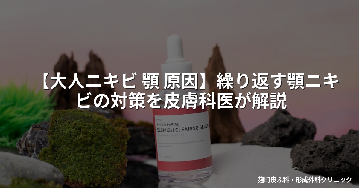 【大人ニキビ 顎 原因】繰り返す顎ニキビの対策を皮膚科医が解説