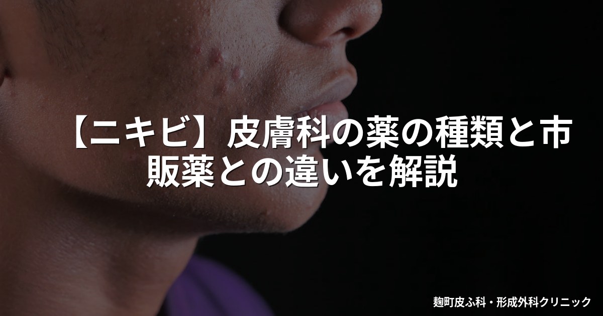 【ニキビ】皮膚科の薬の種類と市販薬との違いを解説