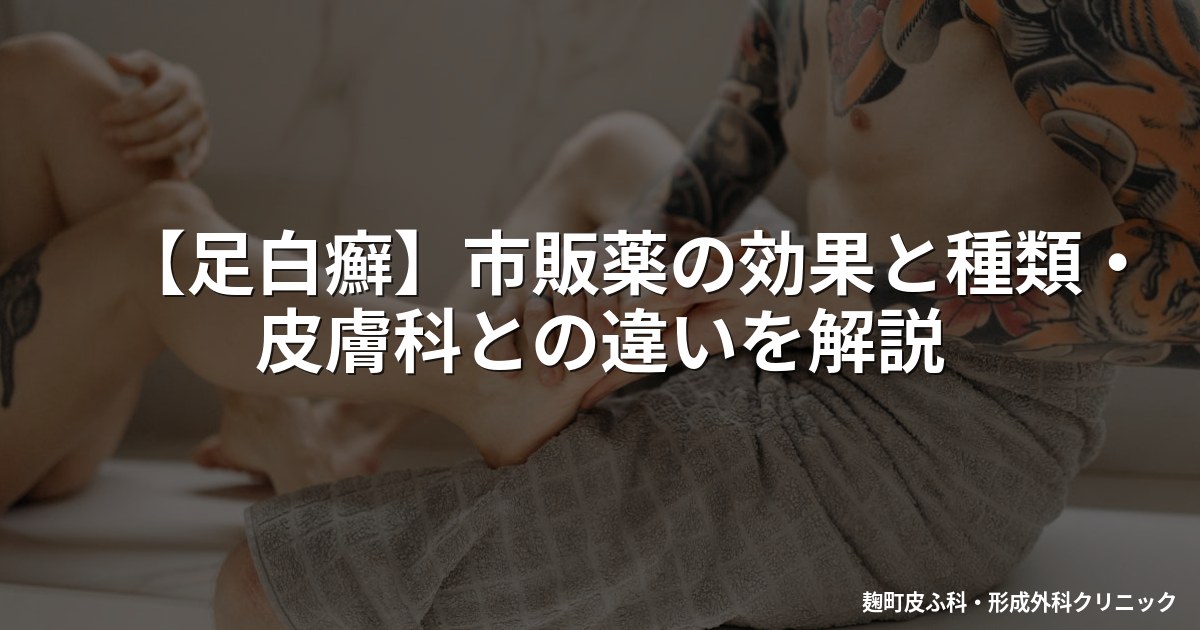【足白癬】市販薬の効果と種類・皮膚科との違いを解説
