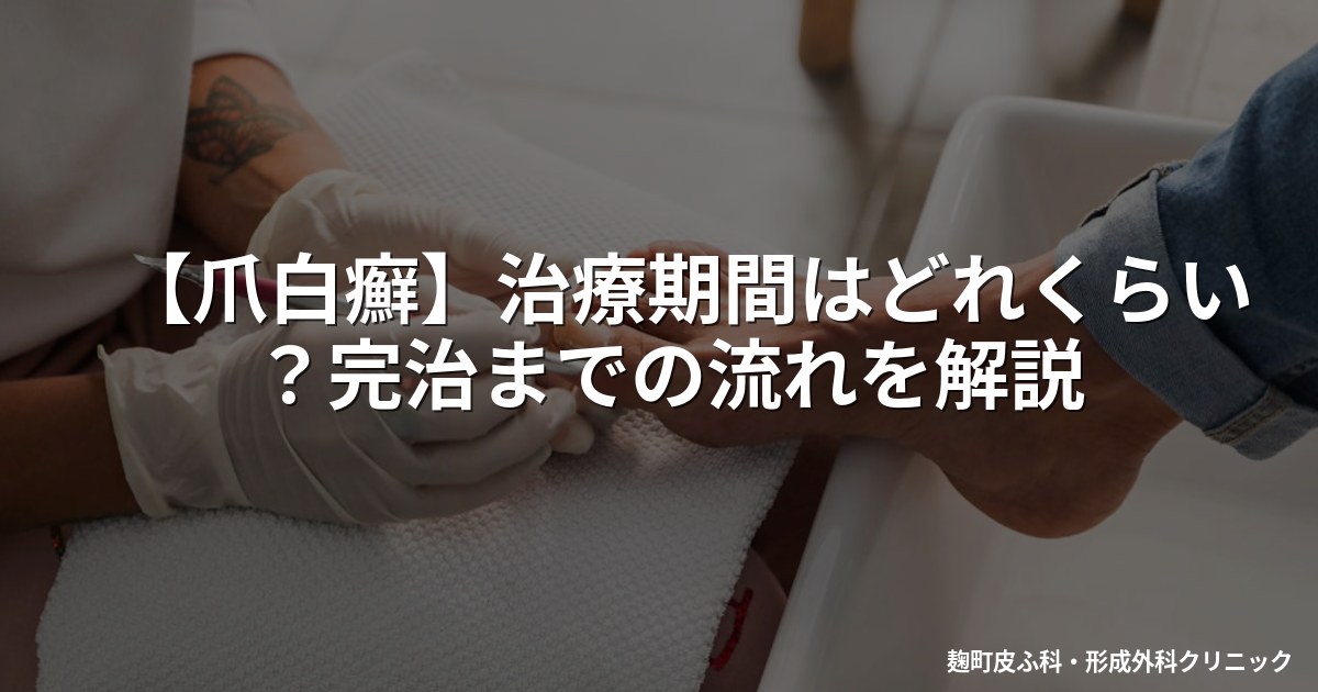 【爪白癬】治療期間はどれくらい?完治までの流れを解説