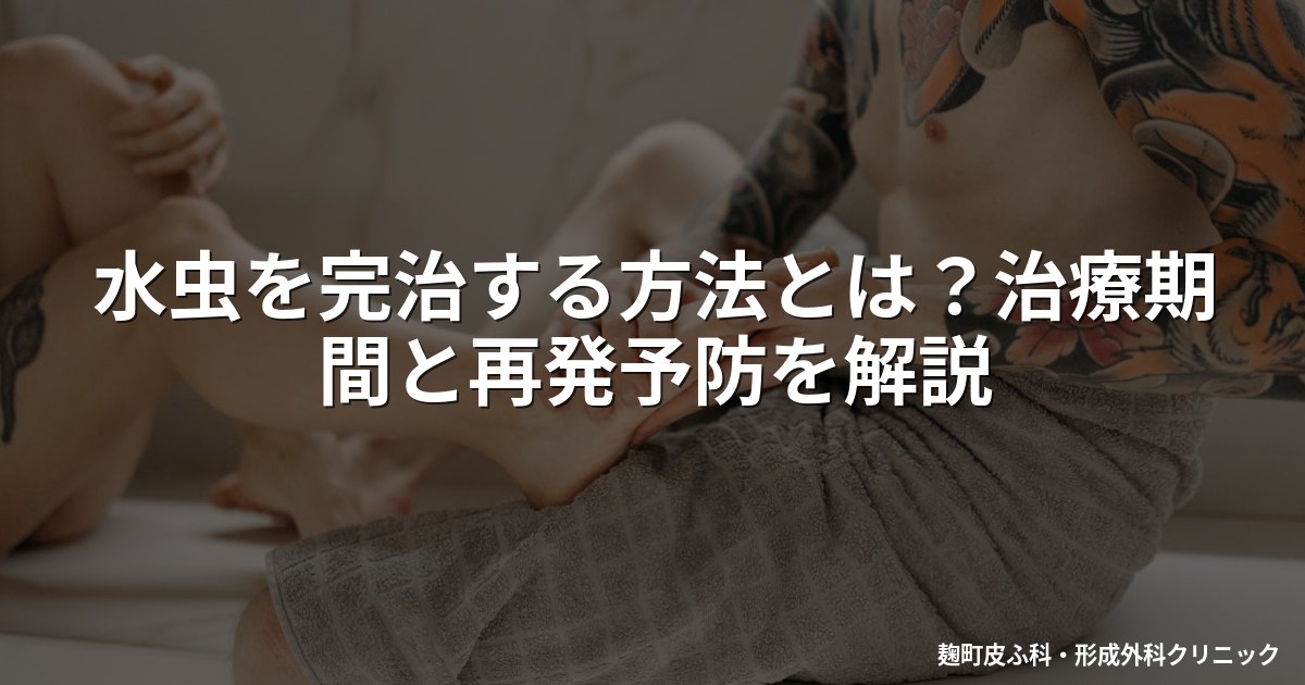 水虫を完治する方法とは？治療期間と再発予防を解説