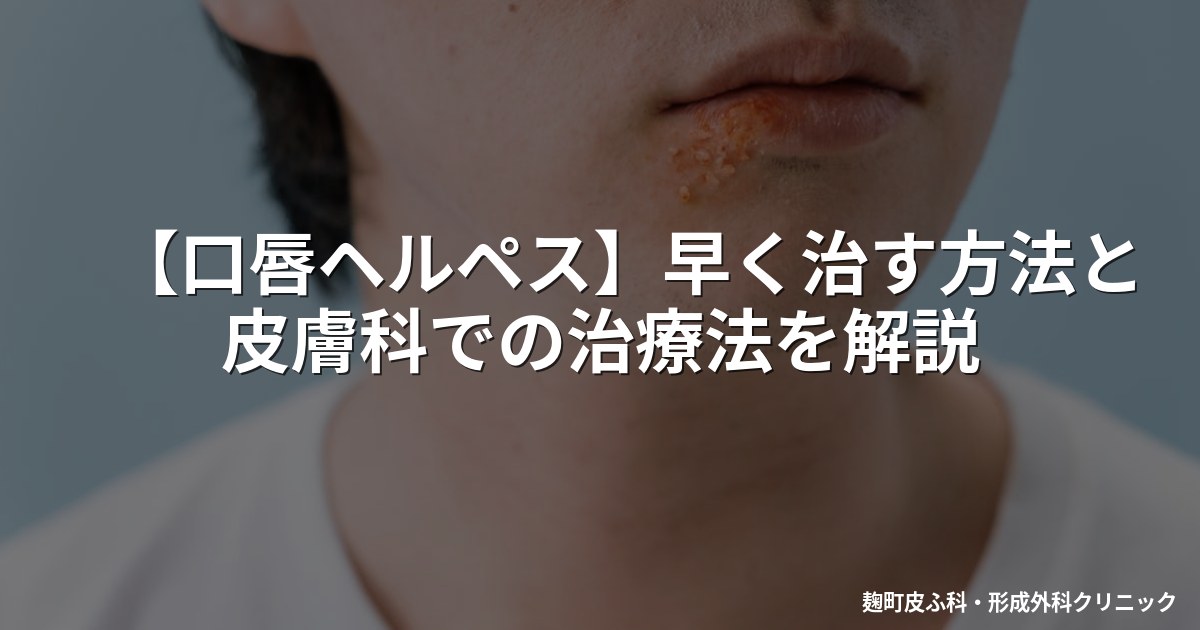 【口唇ヘルペス】早く治す方法と皮膚科での治療法を解説