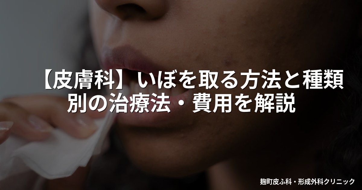 【皮膚科】いぼを取る方法と種類別の治療法・費用を解説