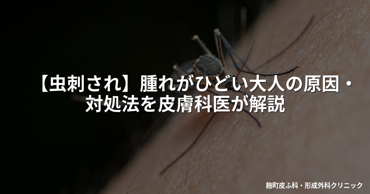【虫刺され】腫れがひどい大人の原因・対処法を皮膚科医が解説