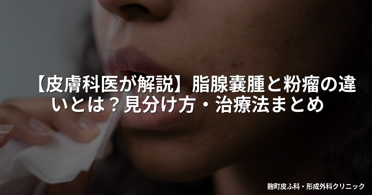 【皮膚科医が解説】脂腺嚢腫と粉瘤の違いとは？見分け方・治療法まとめ