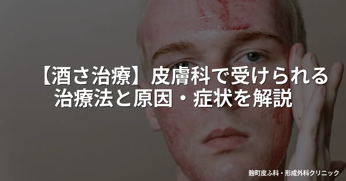 【酒さ治療】皮膚科で受けられる治療法と原因・症状を解説