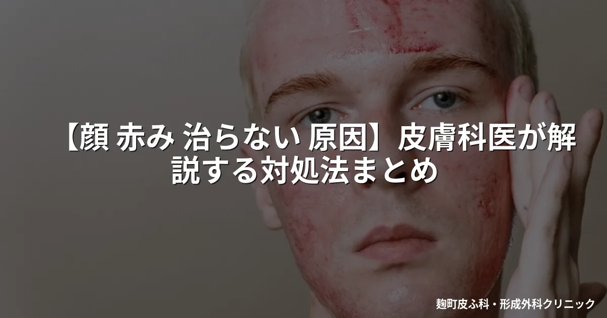 【顔 赤み 治らない 原因】皮膚科医が解説する対処法まとめ