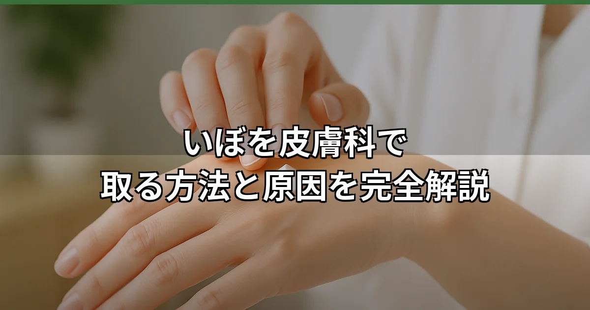 手指に現れたいぼを皮膚科で取る方法の治療イメージ。ざらざらした表面とウイルス感染による特徴を視覚的に示す医学的な被写体。
