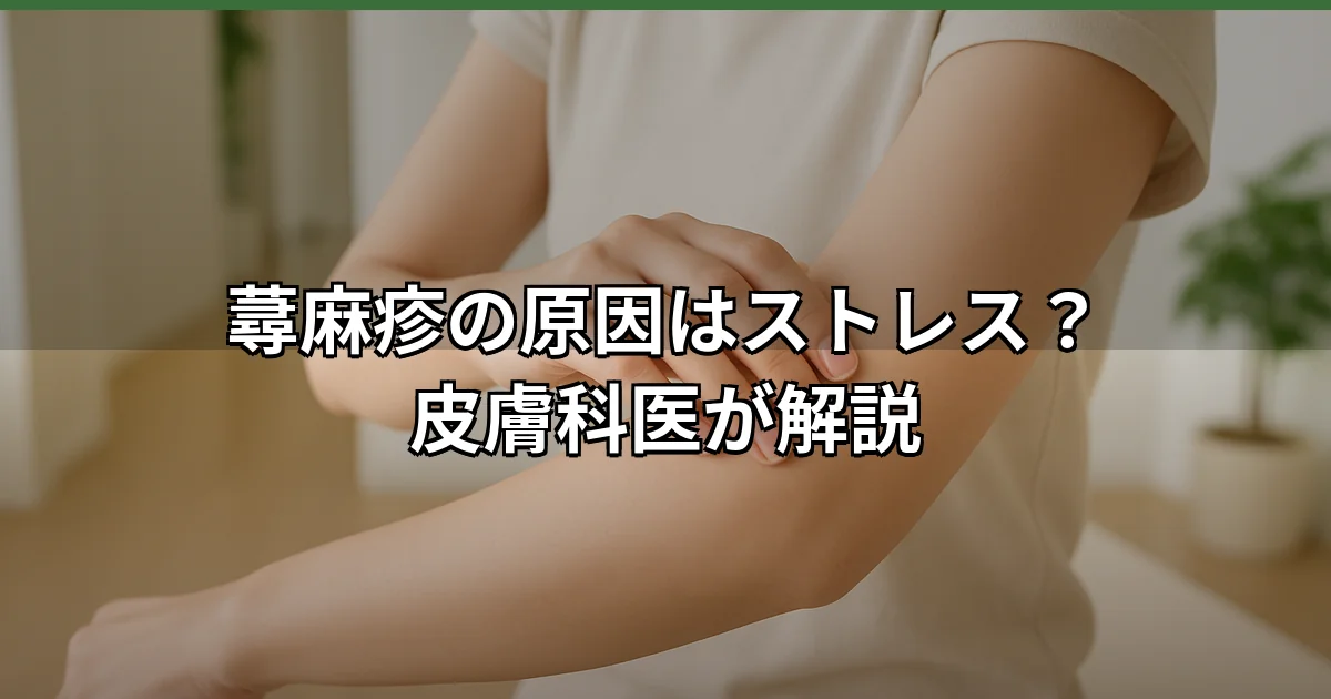 ストレスが原因で腕に現れた蕁麻疹の膨疹を示す医学的な皮膚イメージ