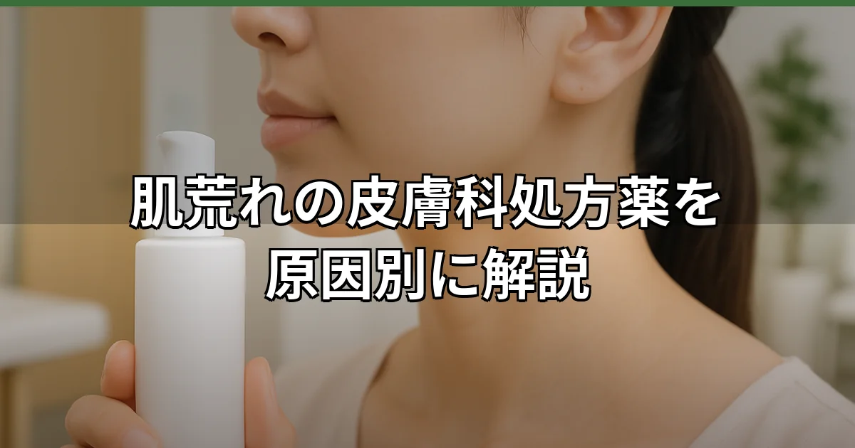 肌荒れの治療に使用される複数の皮膚科処方薬と保湿剤が並ぶイメージ。赤みやかゆみを伴う肌の症状に対する医学的なアプローチを表現しており、皮膚科医による診断に基づいた適切な薬の選択方法を示しています。