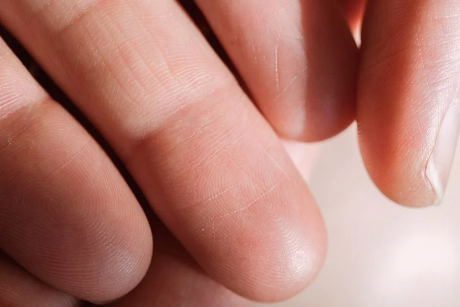 いぼ 取る 方法 皮膚科|セルフケアでできること・してはいけないこと いぼ 取る 方法 皮膚科|セルフケアでできること・してはいけないこと