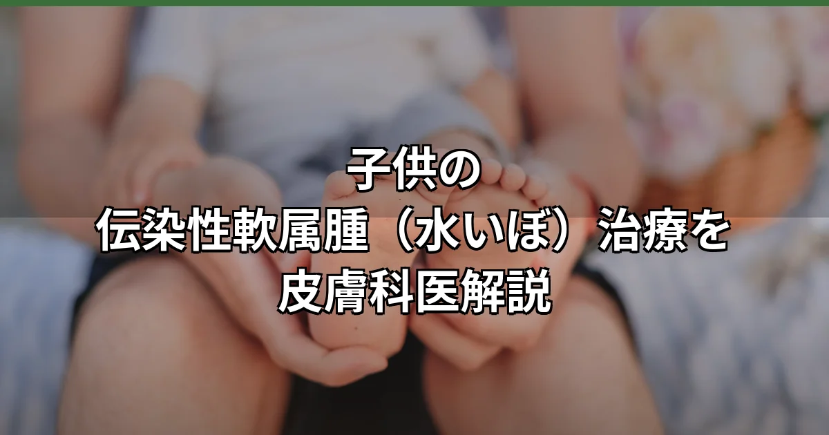 子供の腕に生じた伝染性軟属腫（水いぼ）の半球状の丘疹をとらえたクローズアップ写真。治療前の典型的な皮膚症状