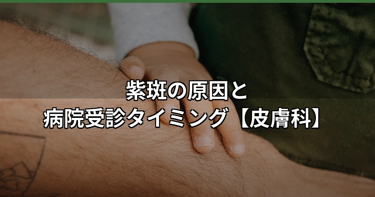 皮膚に紫斑が現れた前腕のクローズアップ。内出血による紫色の斑点の原因を病院で診断するための皮膚科受診をイメージした写真
