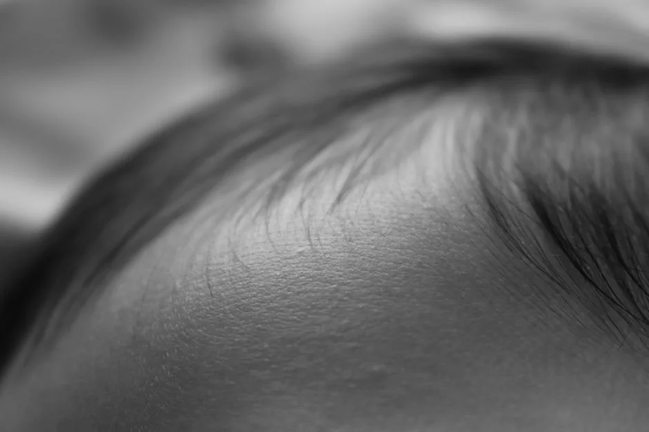 伝染性軟属腫 子供 治療｜見落としがちな2つの誤解